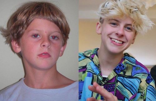NoahFinnce before and after 10 years